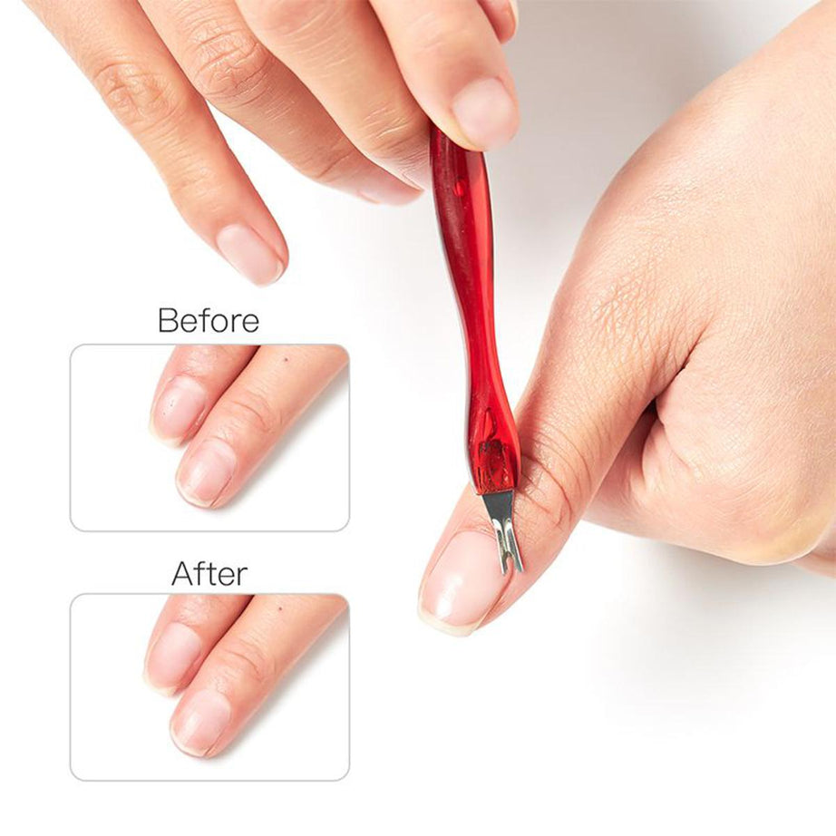 Dead Skin Remover Fork Tool