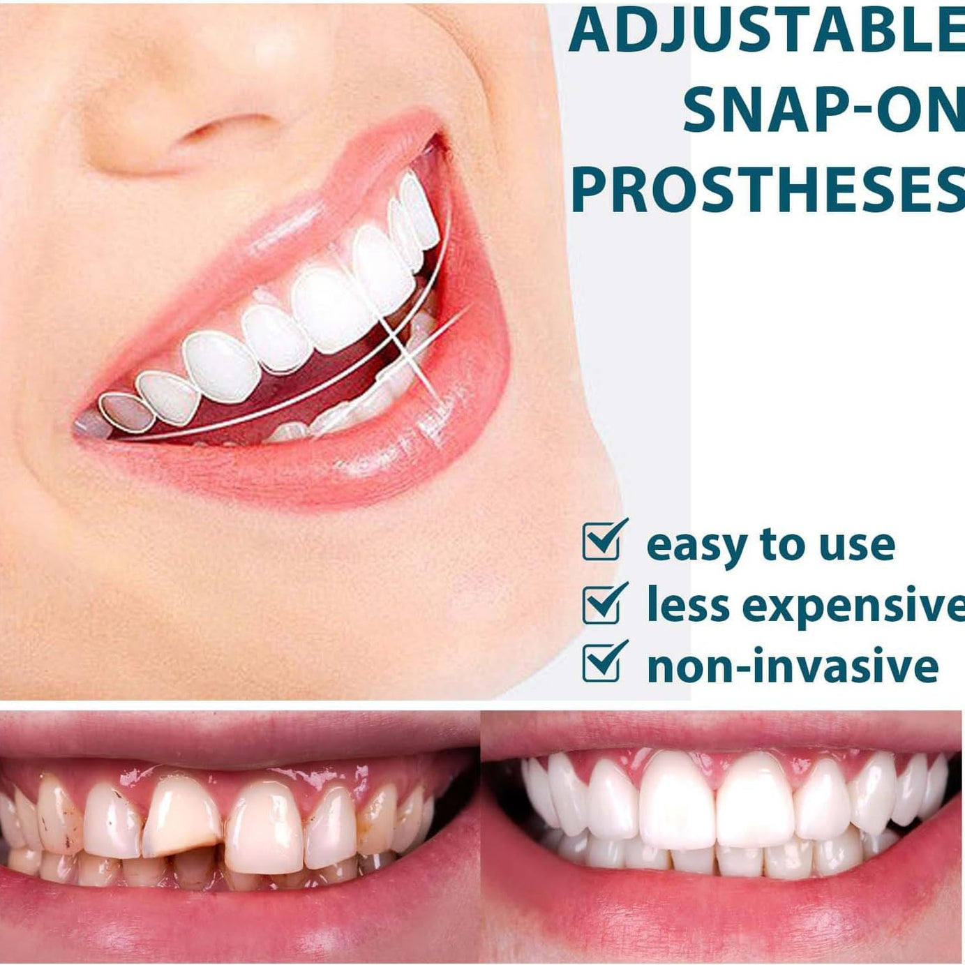 Snap On Smile Veneers Moldable False Artificial Braces Teeth Kits For Men And Women